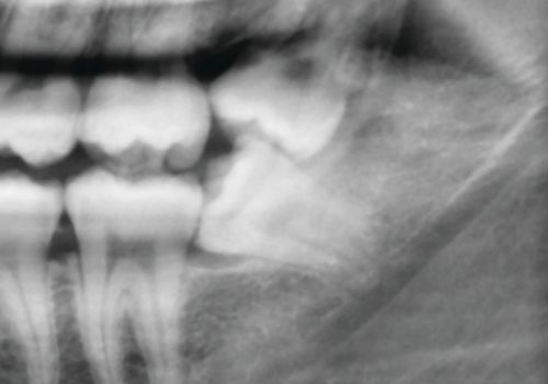 Dr Ben Atkinson Case 1