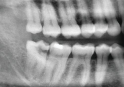 Dr Ben Atkinson Case 2
