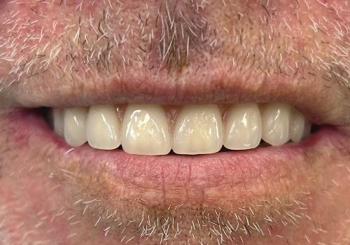 Dr Habib Ur Rehman After