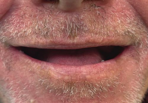 Dr Habib Ur Rehman Before