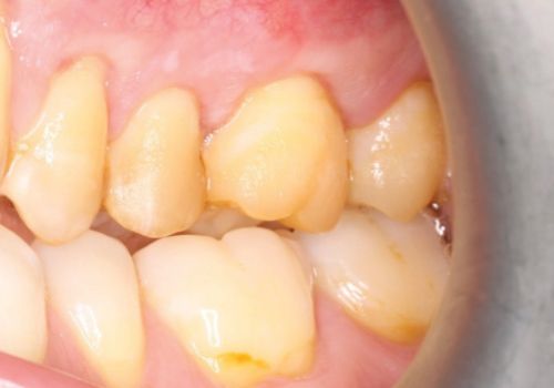 Dr Loreana Moreschi After