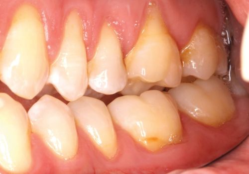 Dr Loreana Moreschi Before