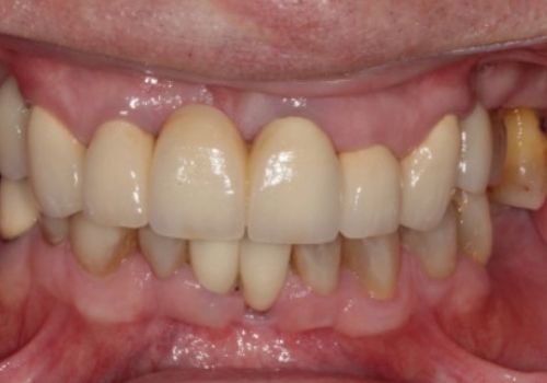 Dr Radwan Quayyum After