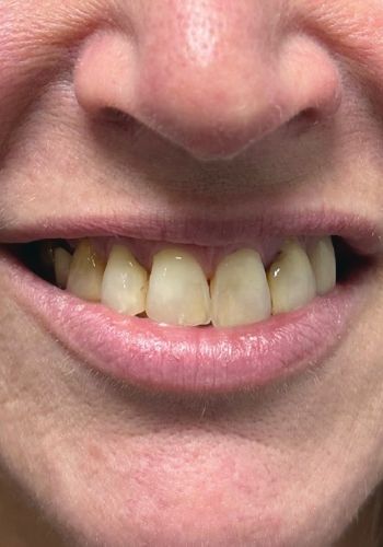 Dr Zahid Chowdhry Before