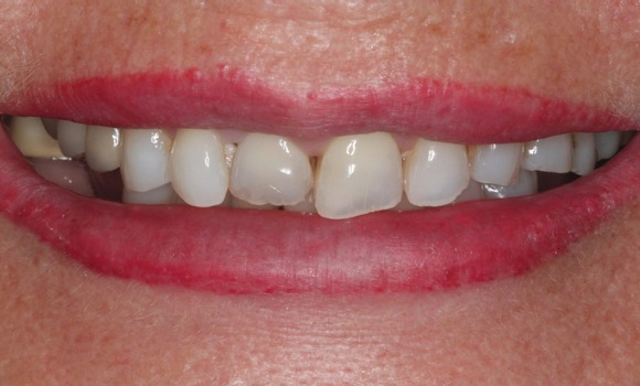 Dr Zohaib Khwaja Before