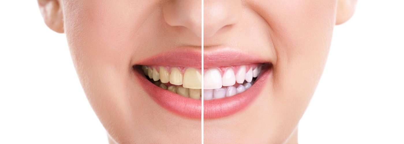 Same Day Smile
